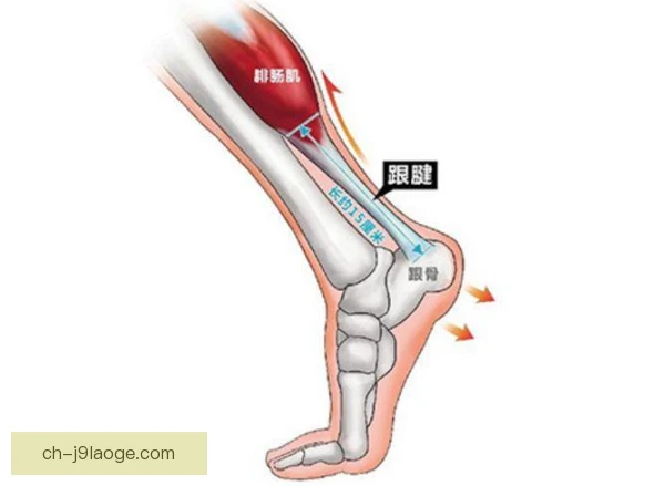 二十四小时跑跟腱长度评估，恢复方案需重写